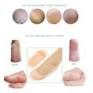 Slcone Protector Mosturzng Socks for FootCare and Heel Cracks FULL and HALF and TOE 3 Pack.jpg