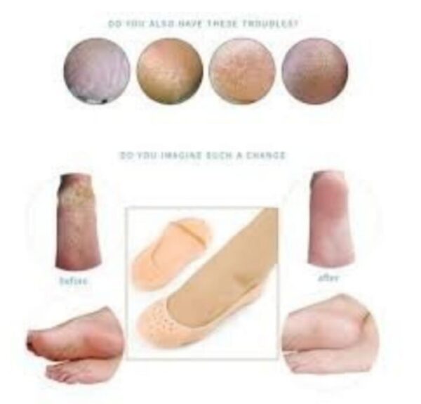Slcone Protector Mosturzng Socks for FootCare and Heel Cracks FULL and HALF and TOE 3 Pack.jpg