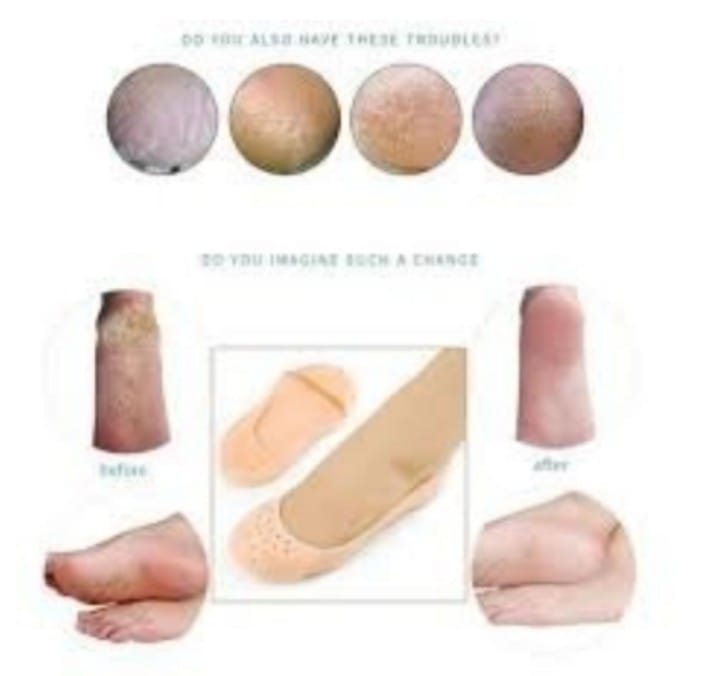 Slcone Protector Mosturzng Socks for FootCare and Heel Cracks FULL and HALF and TOE 3 Pack.jpg